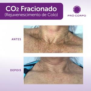 Rejuvenescimento: Fotos de Antes e Depois